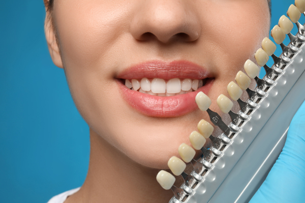 Understanding The Dental Veneers Process