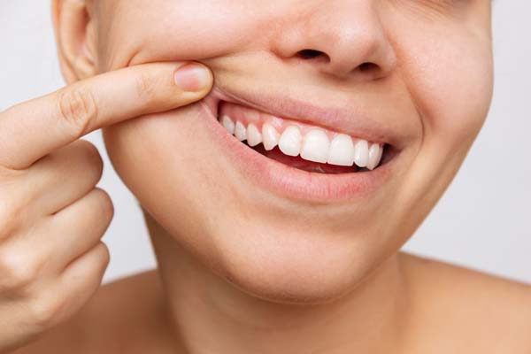 Is Teeth Whitening Safe For Sensitive Teeth?